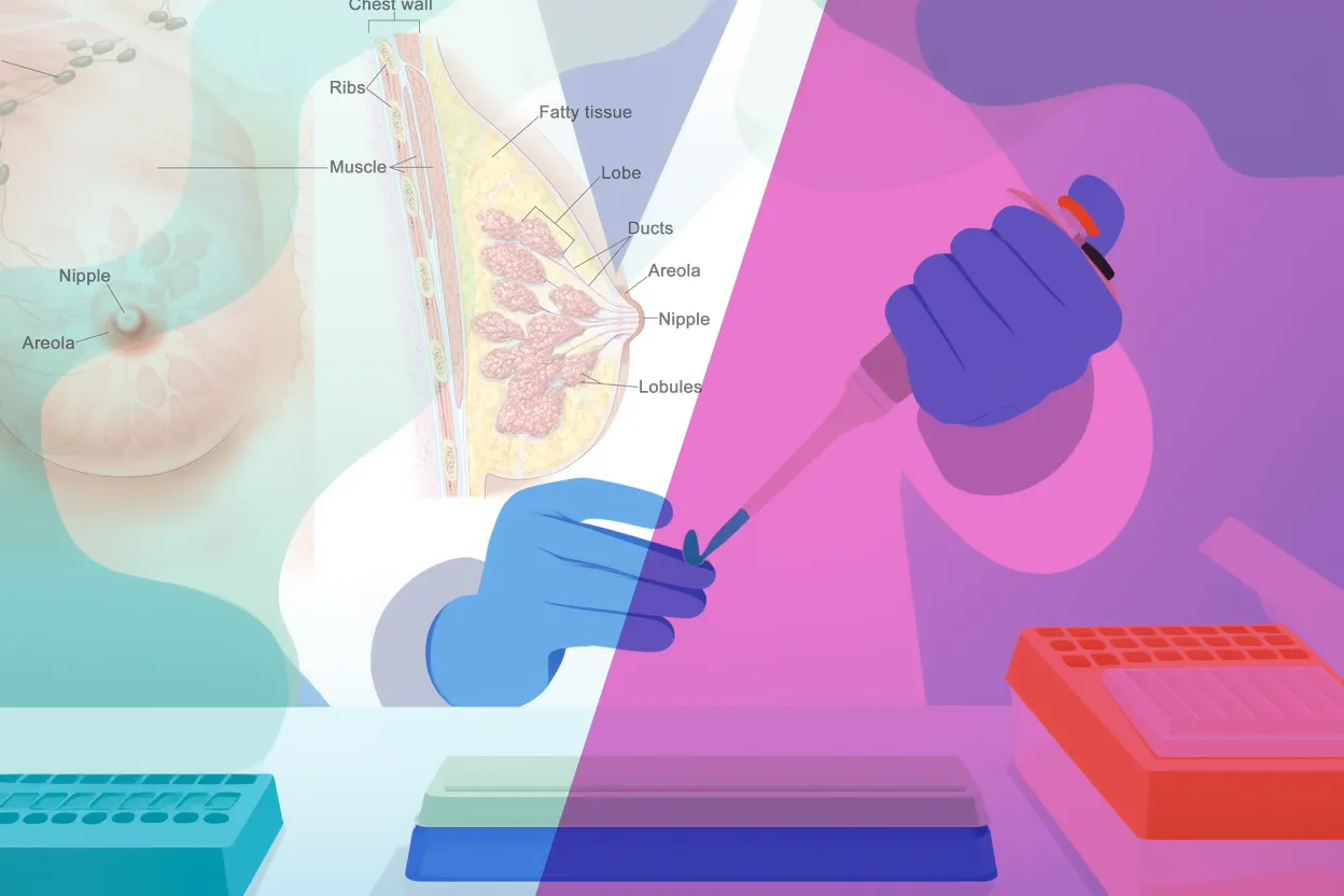 Breast Cancer Research At a Serious Crossroads